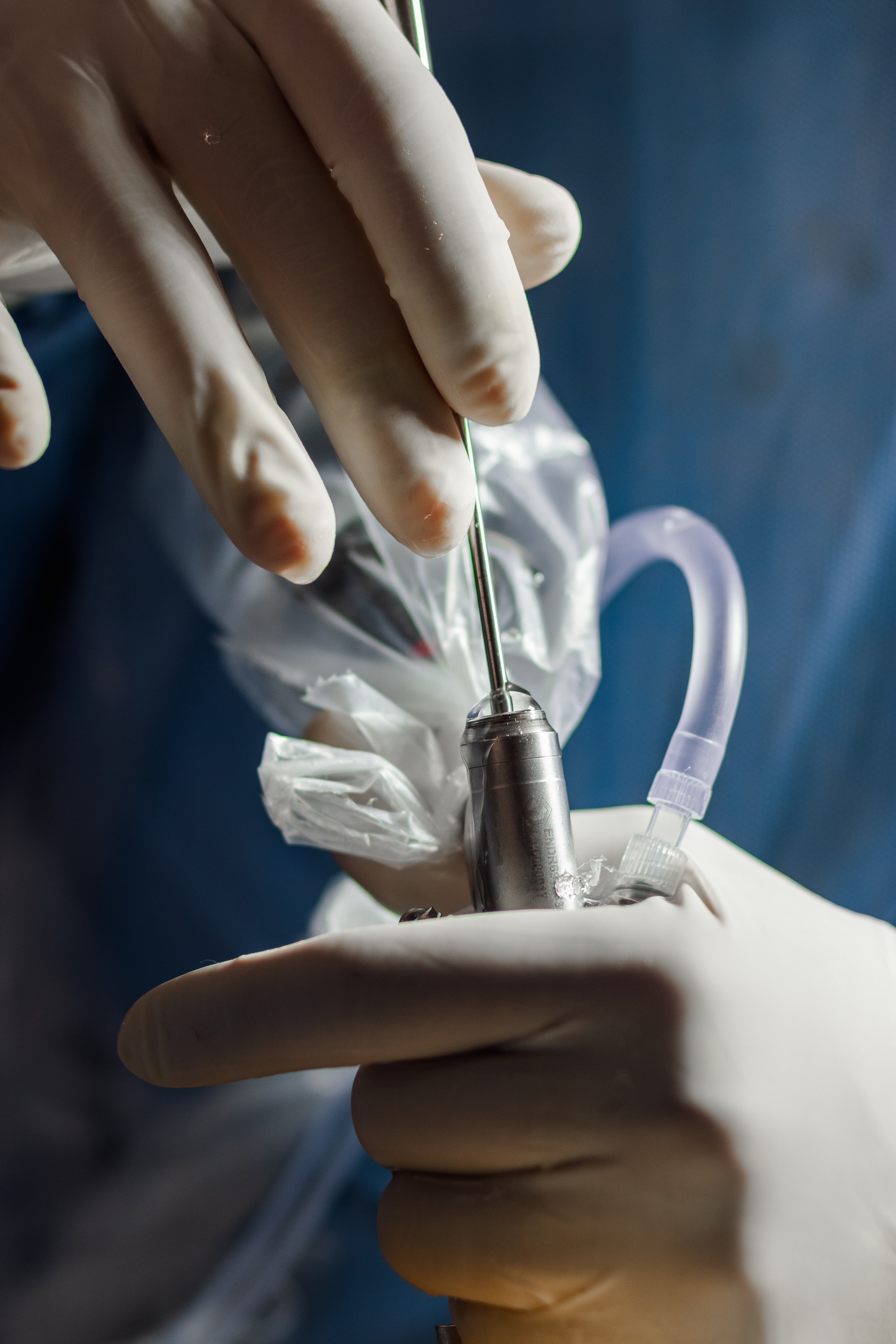 Anatomia da Coluna Vertebral 3D - Cirurgia Minimamente Invasiva